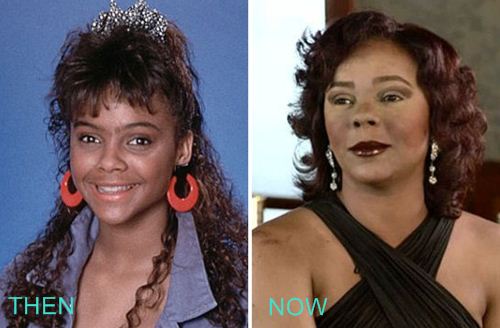 Lark Voorhies Plastics Surgery Before and After