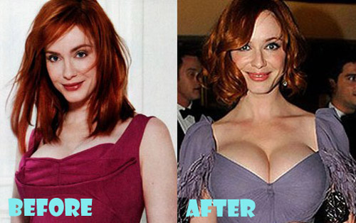 christina hendricks nose job