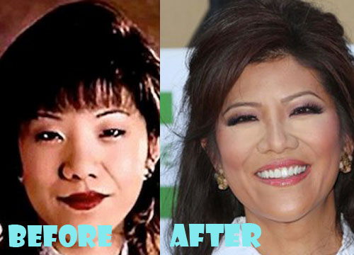 Julie Chen Plastic Surgery