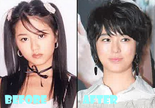 Yoon Eun Hye Plastic Surgery Before and After - Lovely Surgery