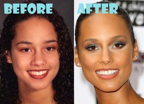 alicia nose keys surgery job plastic before breast much celebrity liposuction augmentation cost average face lift thread she increase cup