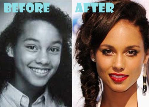 alicia keys nose job