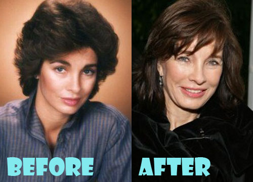 Anne Archer Plastic Surgery Before And After Pictures Lovely Surger