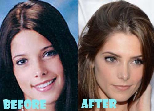 ashley greene nose job