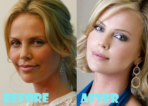 Charlize Theron Plastic Surgery Before And After Pictures Lovely Surgery 