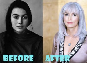 Emmylou Harris Plastic Surgery Before And After Picture Lovely Surgery