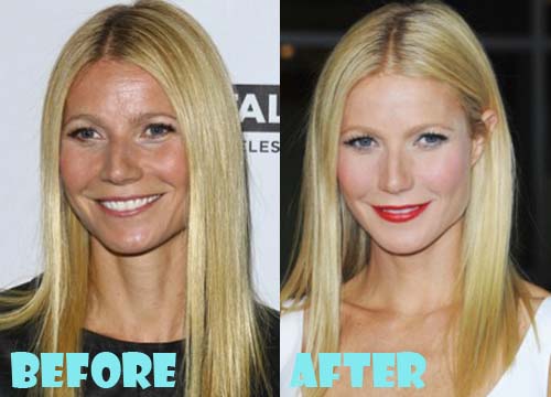 Gwyneth Paltrow Plastic Surgery Before And After Facelift Lovely Surgery