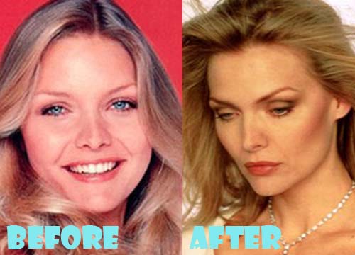 Michelle Pfeiffer Plastic Surgery Nose Job
