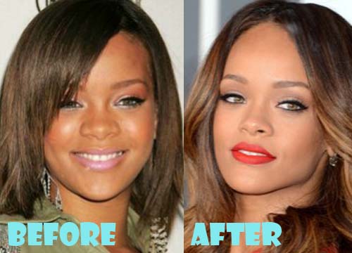 Rihanna Plastic Surgery Nose Job