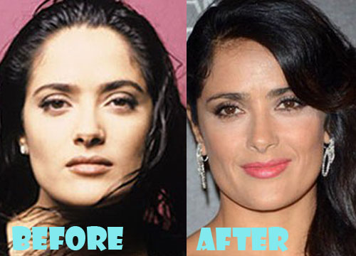 Salma Hayek Plastic Surgery Nose Job