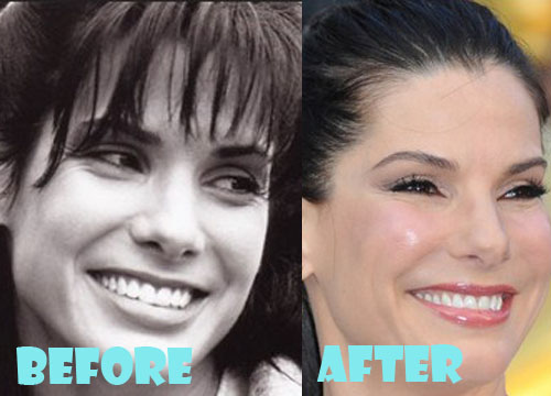 Sandra Bullock Plastic Surgery Nose Job