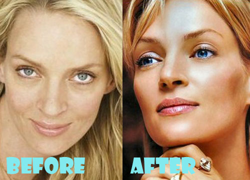 uma thurman plastic surgery 2022