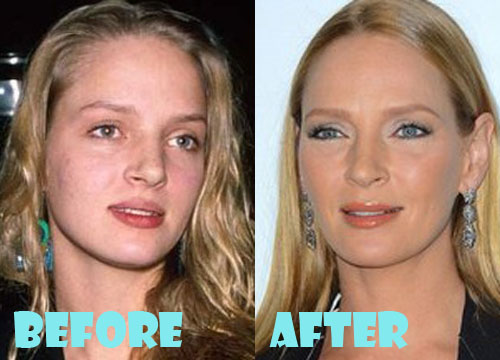 Uma Thurman Plastic Surgery Before And After Picture Lovely Surgery Celebrity Before And