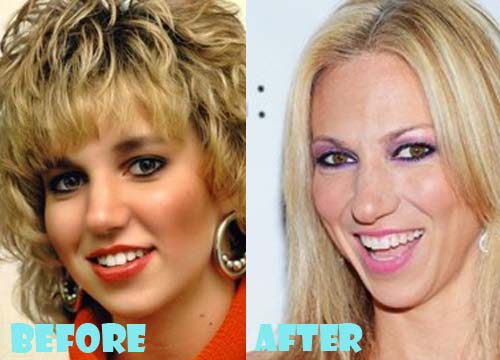 Debbie Gibson Plastic Surgery