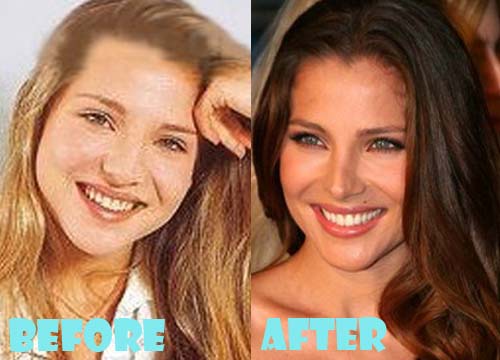 Elsa Pataky Plastic Surgery Before And After Nose Job Lovely Surgery 