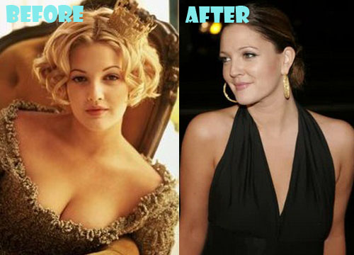 Drew Barrymore Plastic Surgery Boob Job (Breast Reduction)