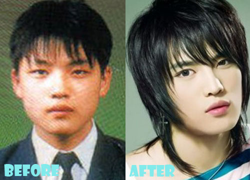 Kim Jaejoong Plastic Surgery Before And After Nose Job