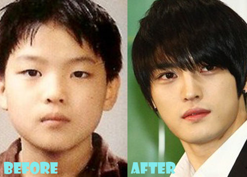 Kim Jaejoong Plastic Surgery Nose Job