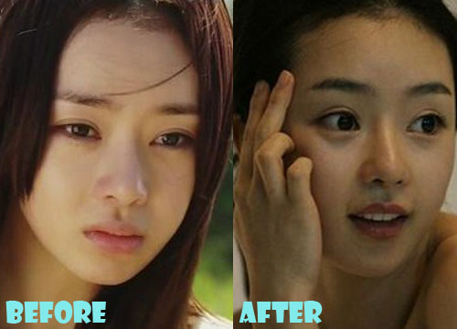 Seo Woo Plastic Surgery