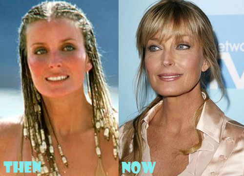 Has Bo Derek Had Plastic Surgery