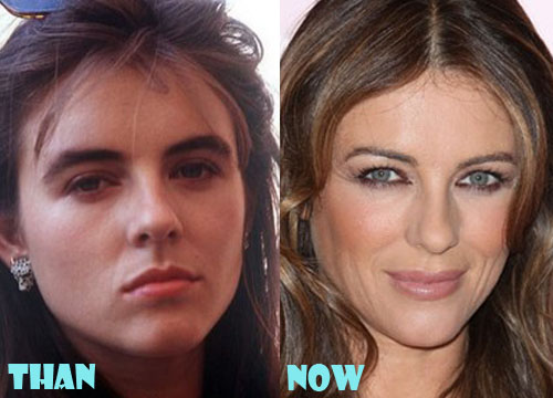 Elizabeth Hurley Plastic Surgery Before And After Photos Lovely