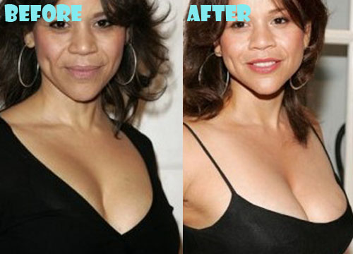 Rosie Perez Plastic Surgery Breast Implant Before and After