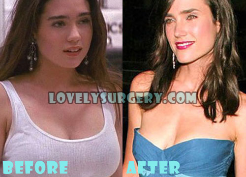 Jennifer Connelly Plastic Surgery Boob Job (Breast Reduction)