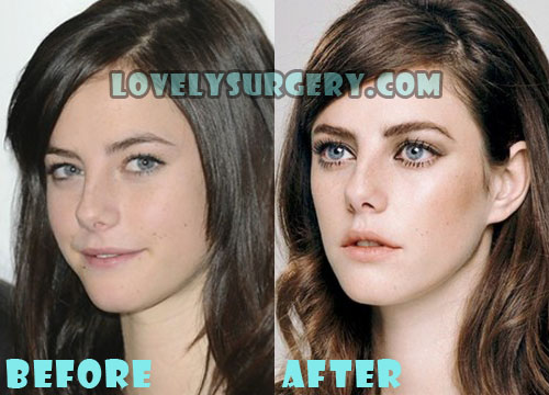 Kaya Scodelario Plastic Surgery Nose Job