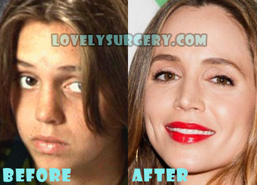 Eliza Dushku Plastic Surgery Nose Job