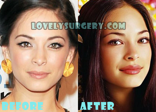 kristin kreuk nose job