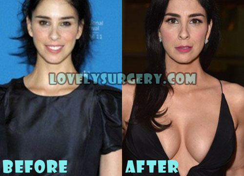 Sarah Silverman Boob