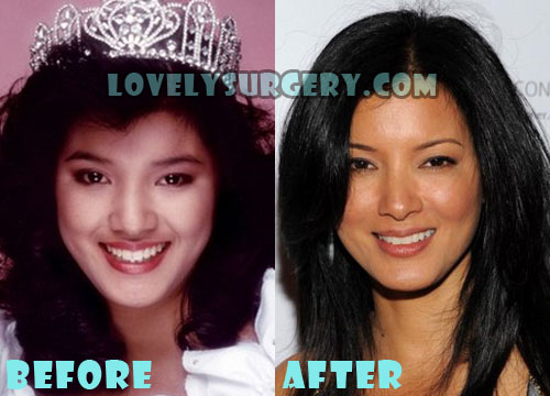 Kelly Hu Plastic Surgery Before After, Breast Implants