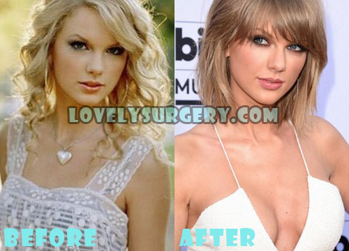 Taylor Swift Plastic Surgery Boob Job