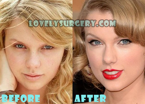 taylor swift before and after nose job