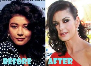 Catherine Zeta Jones Plastic Surgery Before and After Pictures - Lovely ...