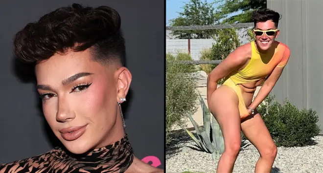 James Charles Opens Up About Botox and Lip Filler Surgery