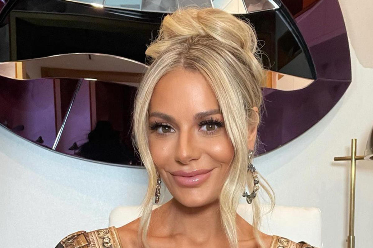 Dorit Kemsley’s Stunning Look: Botox and Fillers, Not Plastic Surgery