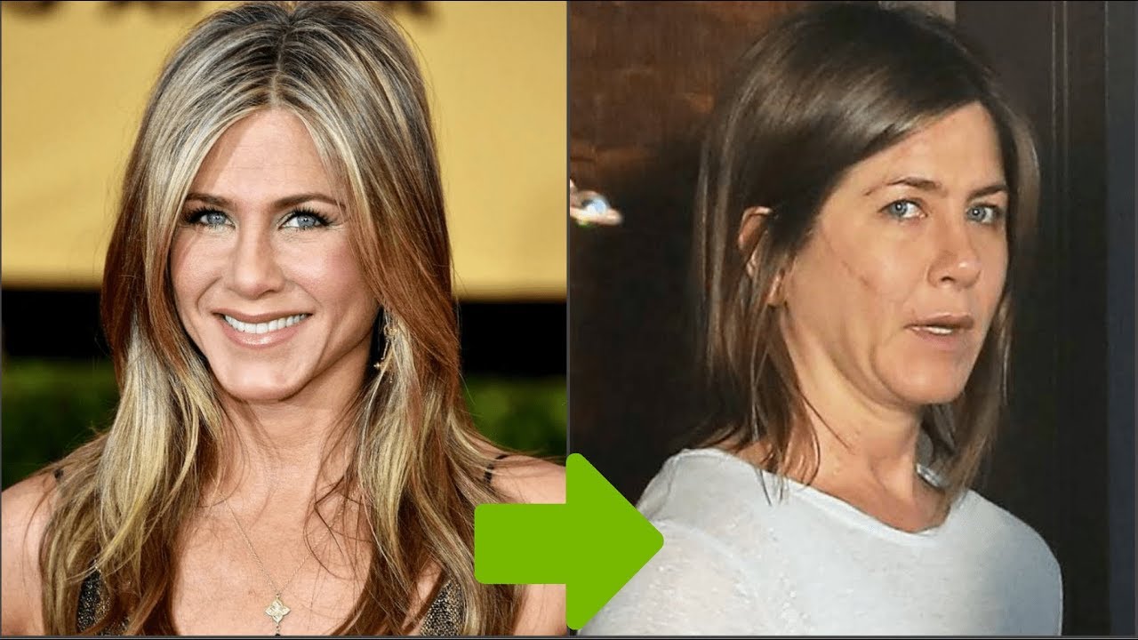 Jennifer Aniston’s Beauty Secrets: Botox, Nose Job, and Plastic Surgery Speculation