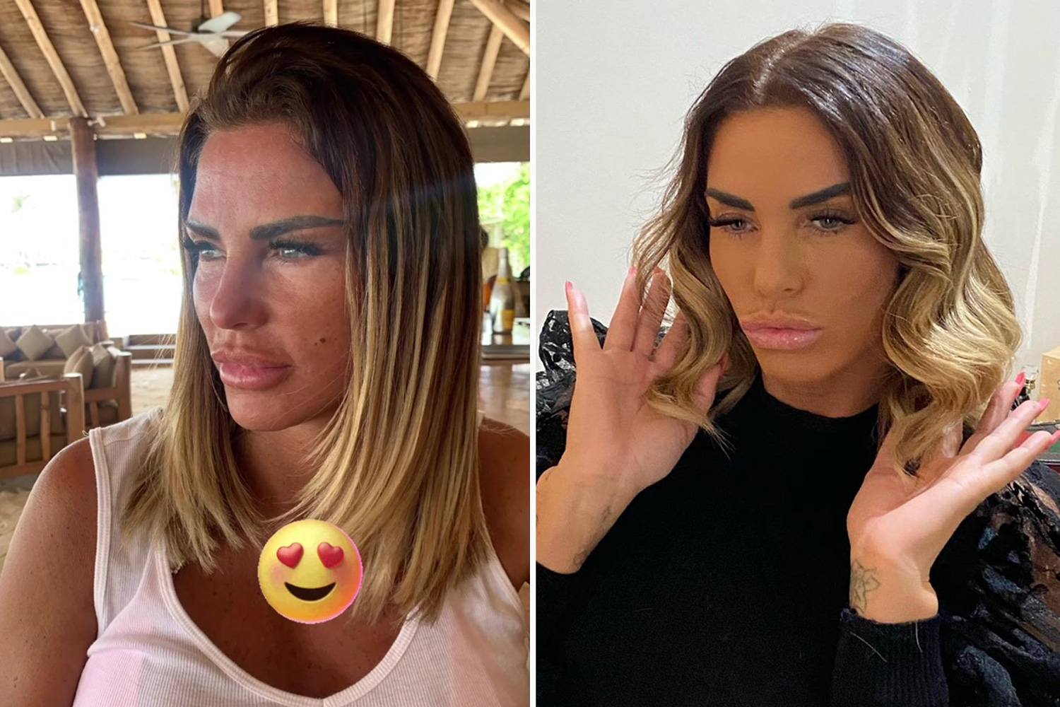 Katie Price’s Bold Journey: From Breast Augmentation to Lip Lifts