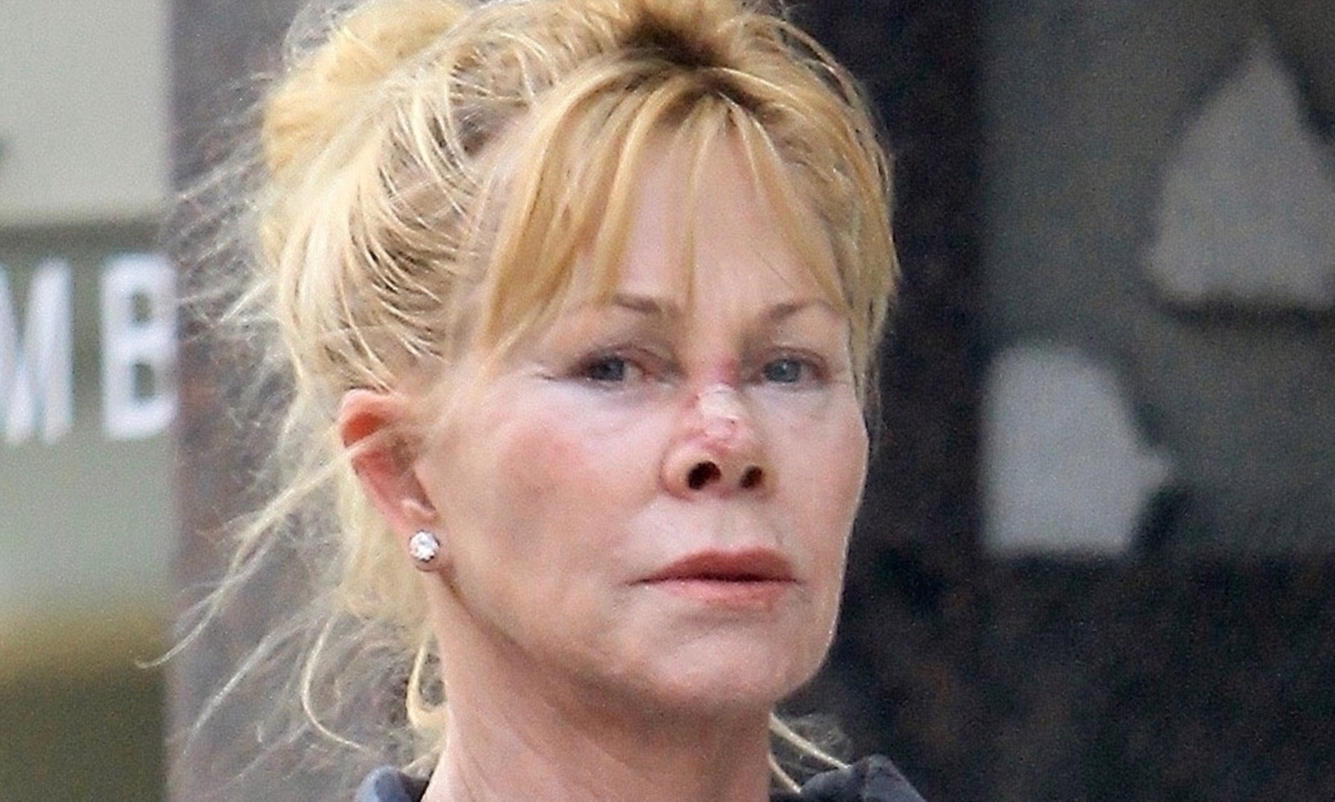 Melanie Griffith’s Plastic Surgery Journey: Botox, Facelifts, and Acceptance