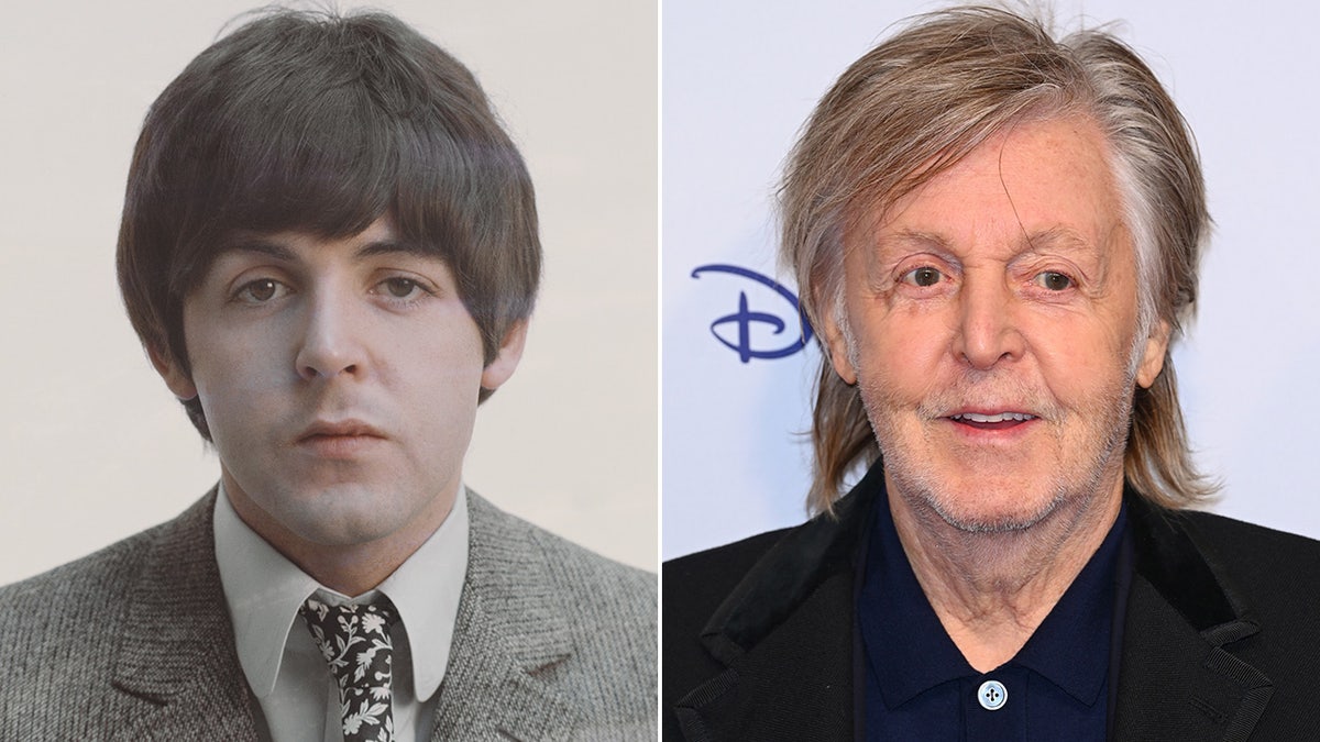 Paul McCartney’s Rumored Botox and the Truth Behind Plastic Surgery