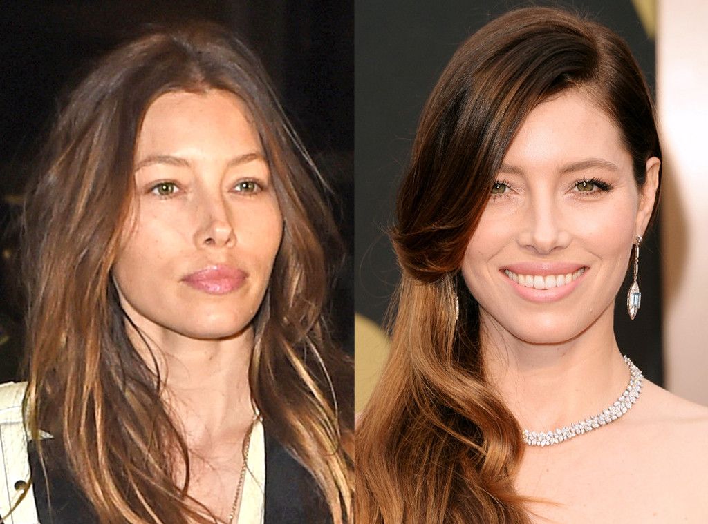 Jessica Biel’s Journey: From Natural Beauty to Plastic Surgery Rumors