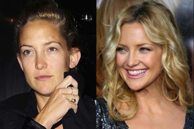 Kate Hudson’s Rhinoplasty and Breast Augmentation: Beauty and Controversy