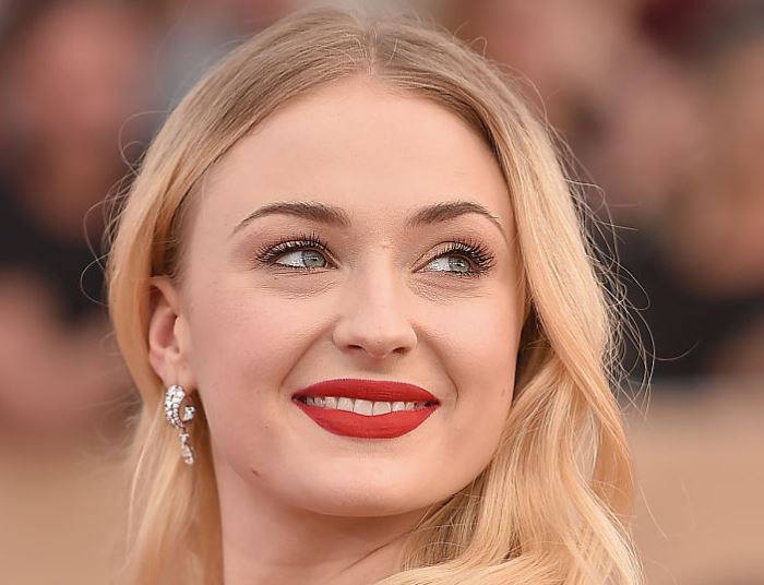 Sophie Turner’s Plastic Surgery Rumors: Rhinoplasty and Lip Fillers Speculated