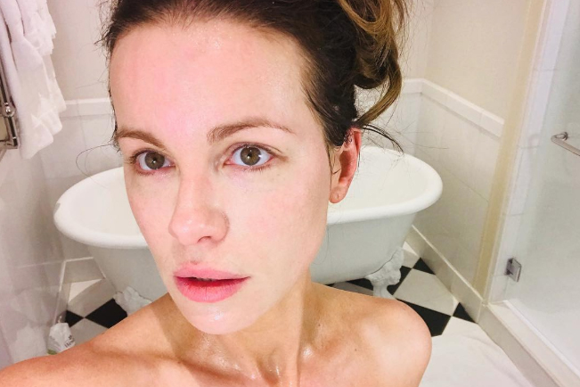 Kate Beckinsale’s Graceful Beauty: No Plastic Surgery, Just Natural Charm